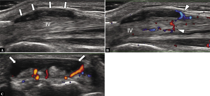 Fig. 11.