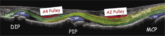 Fig. 14.