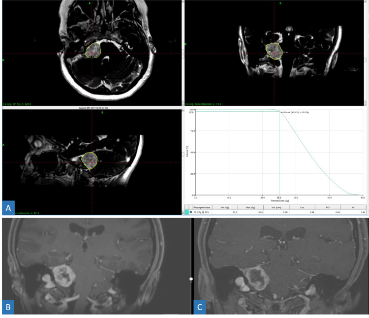 Figure 11