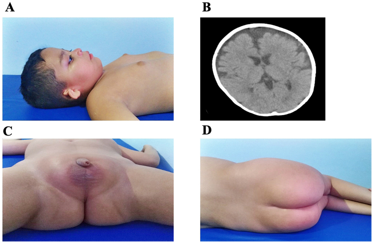 Fig. 1