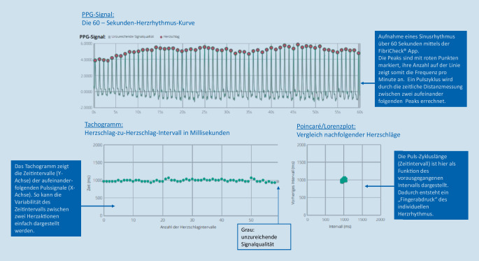 graphic file with name 399_2021_795_Fig2_HTML.jpg