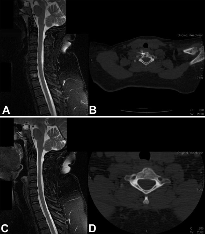 Fig. 1