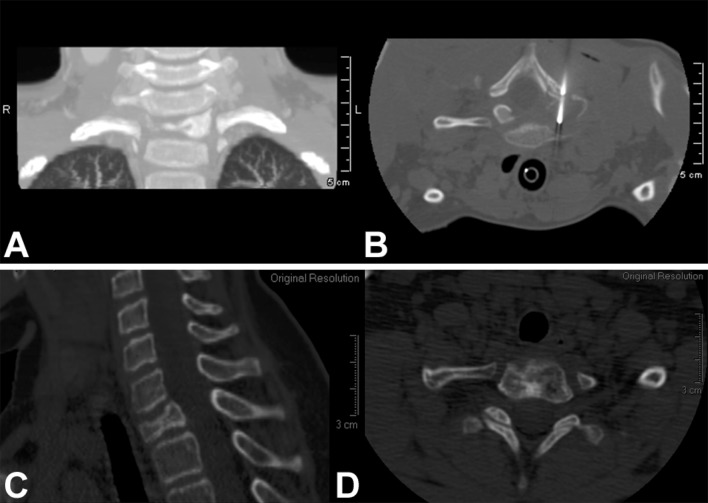 Fig. 2