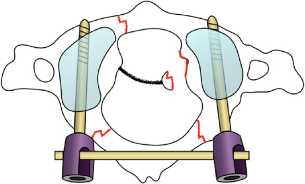 Fig. 9