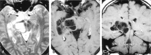 Fig 2.