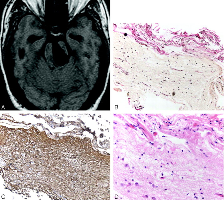 Fig 8.