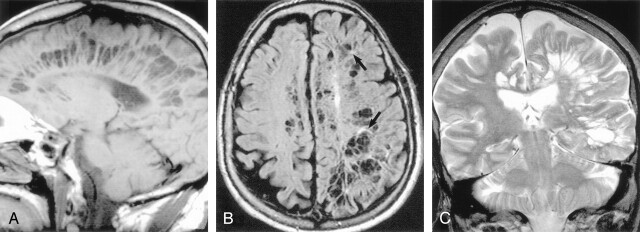 Fig 4.