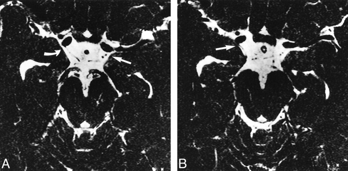 fig 2.