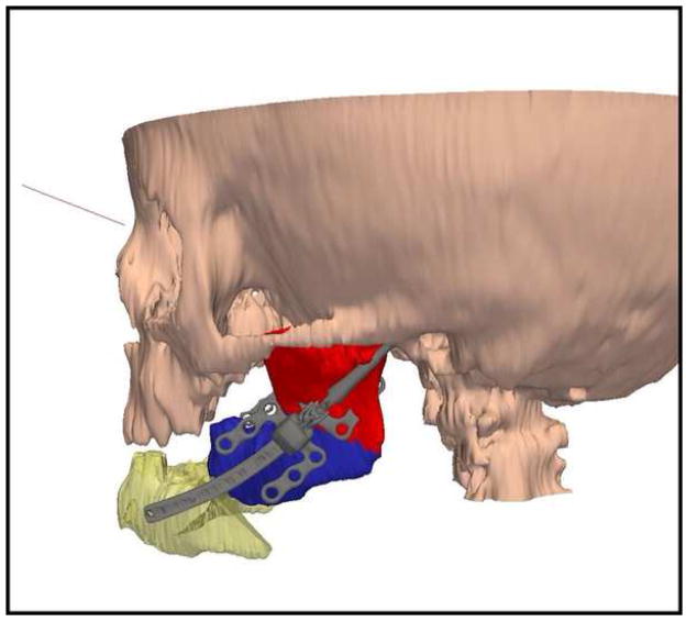 Figure 13