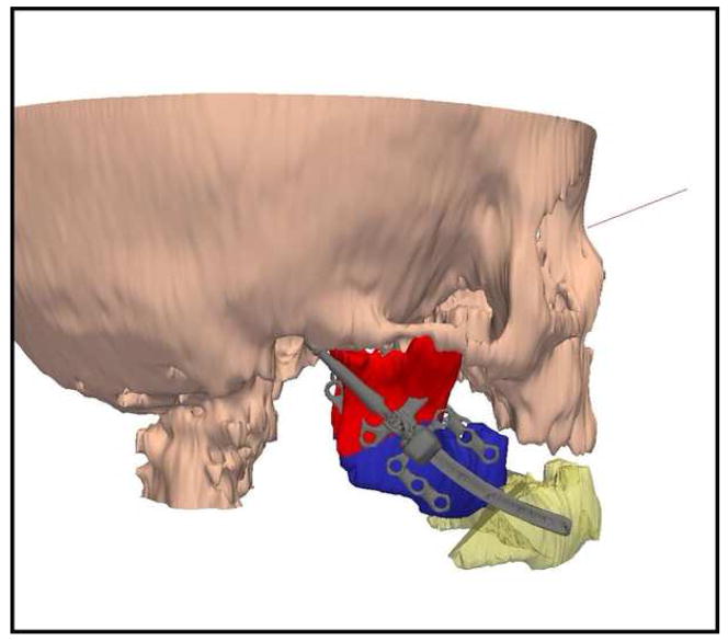 Figure 13