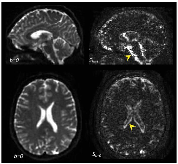 FIG. 6