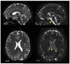 FIG. 6
