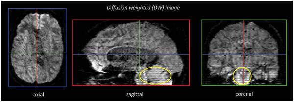 FIG. 4