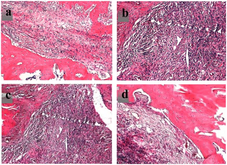 Figure 11.