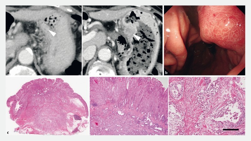 Fig. 2