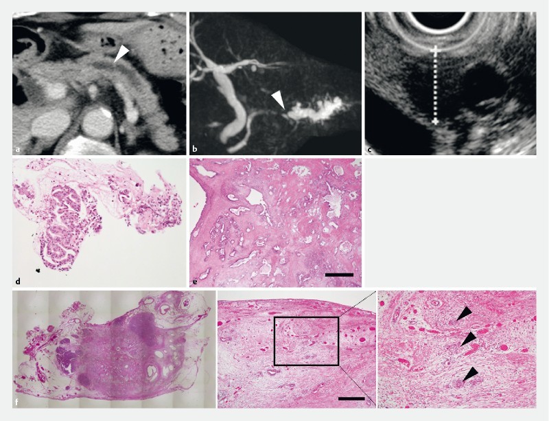 Fig. 1 