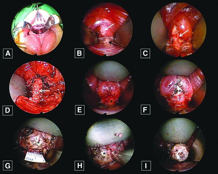 FIG. 3.