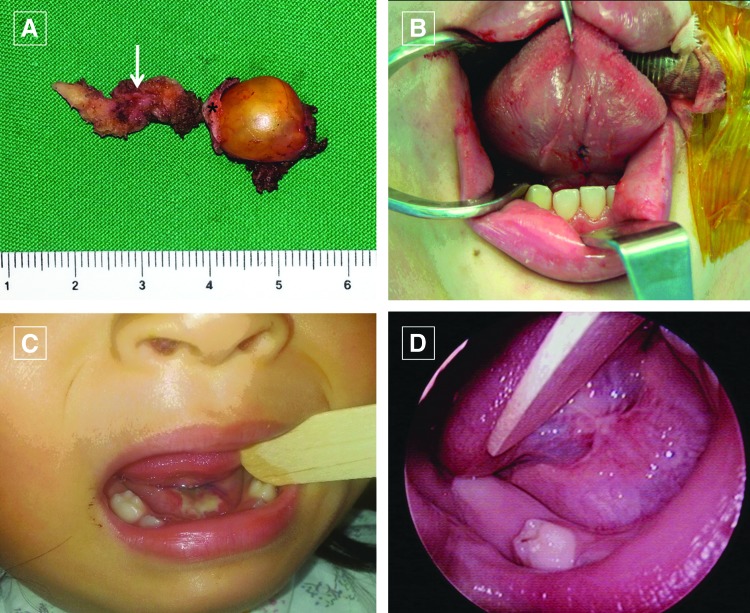 FIG. 4.