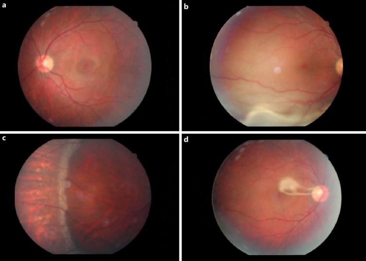 Fig. 1