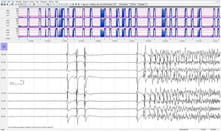 FIGURE 2