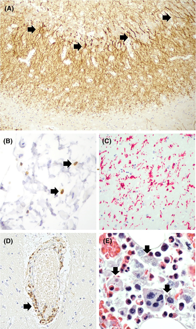 FIGURE 3