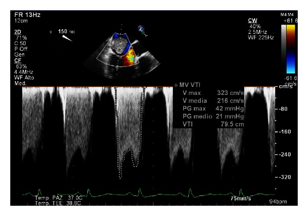 Figure 4