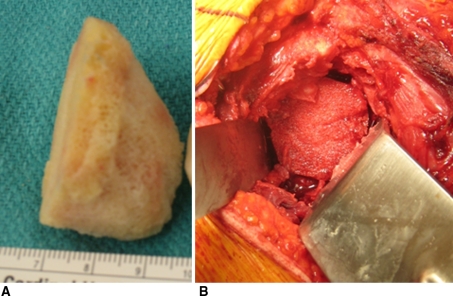 Fig. 2A–B