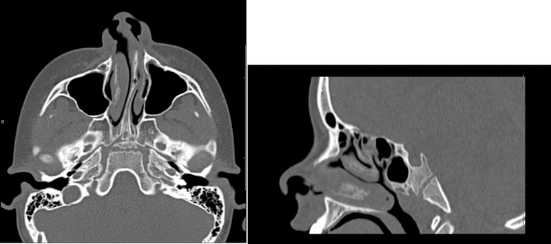 Figure 7: