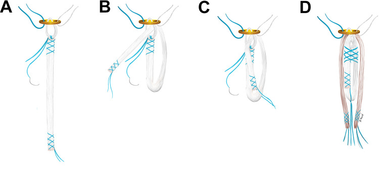 Figure 2.