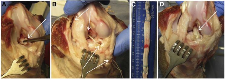 Figure 1