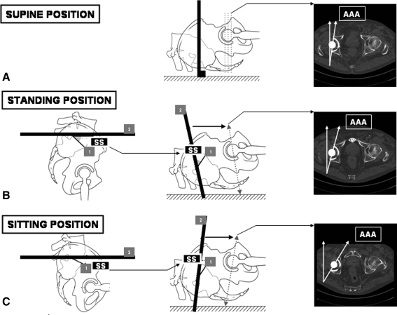 Fig. 3A–C