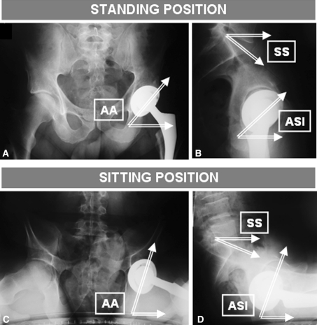 Fig. 1A–D