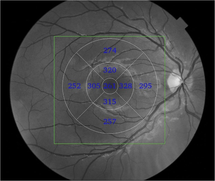 Fig 1