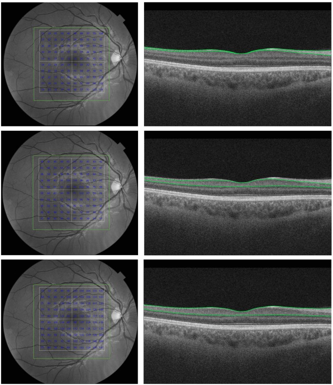 Fig 2