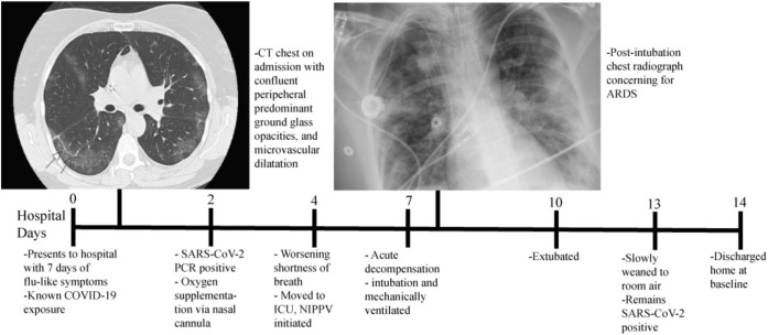 Figure 1