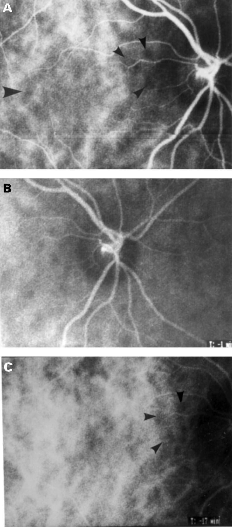 Figure 2  