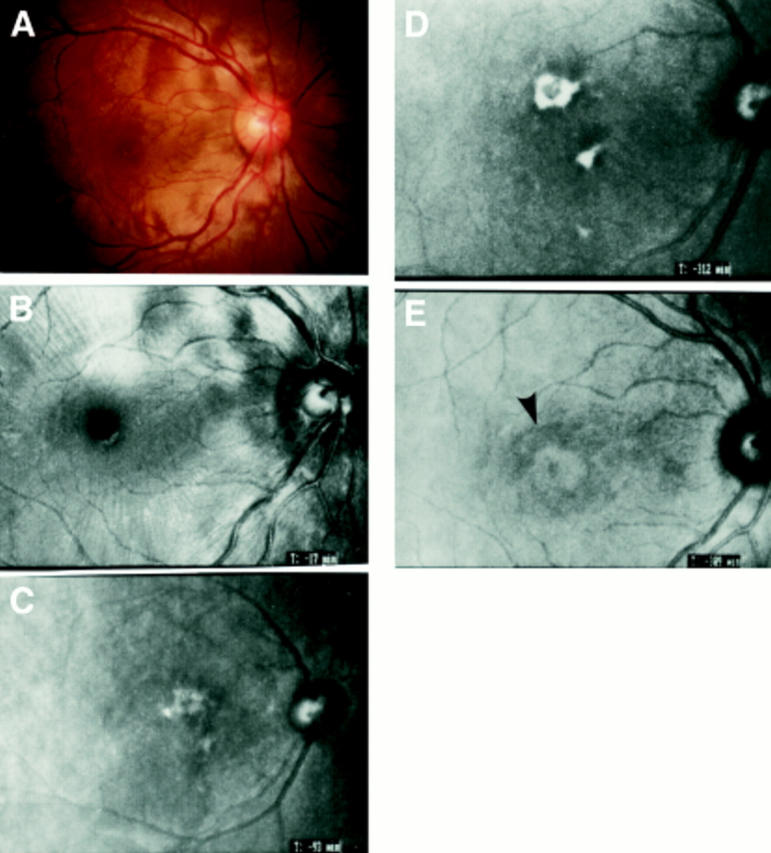 Figure 1  