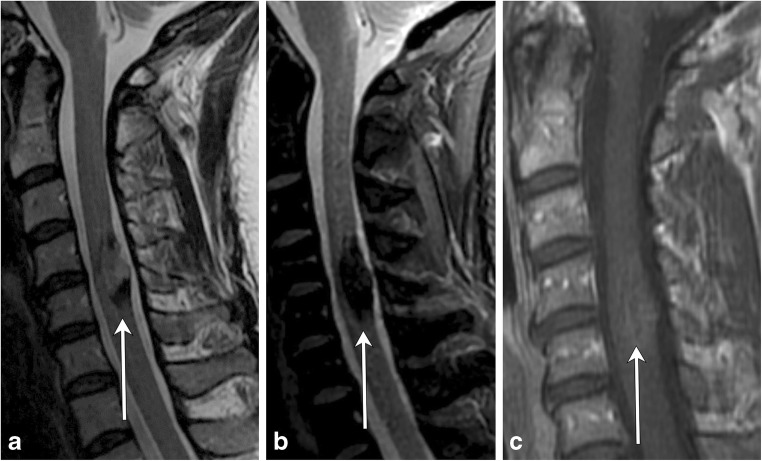 Fig. 21