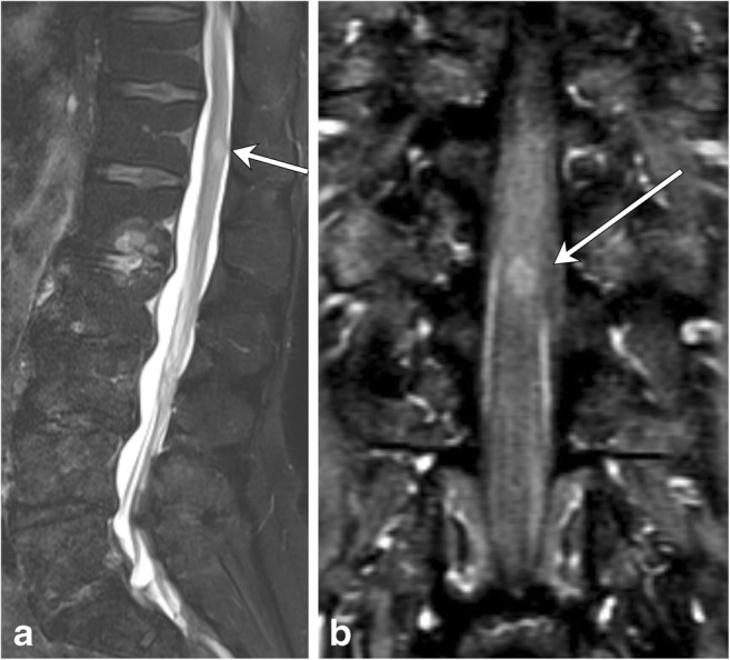 Fig. 16