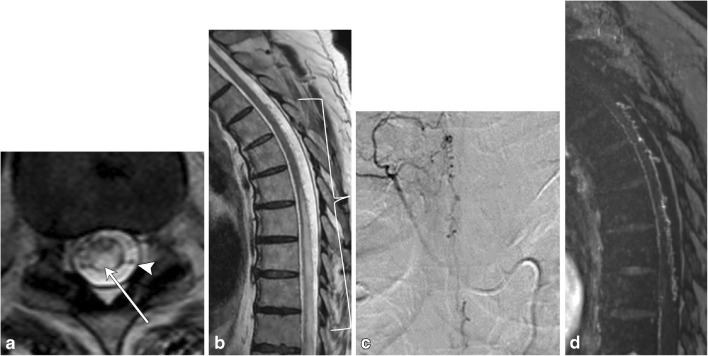 Fig. 19