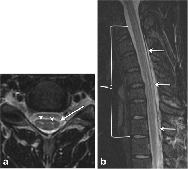 Fig. 24