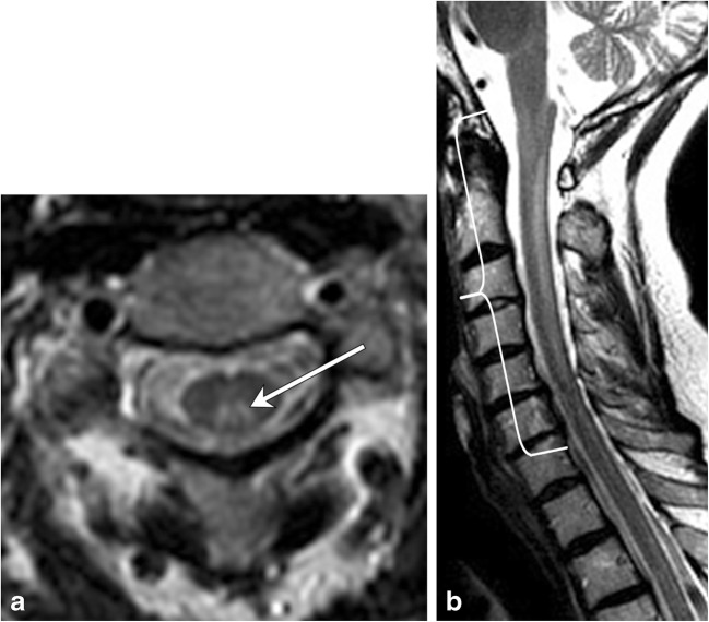 Fig. 11