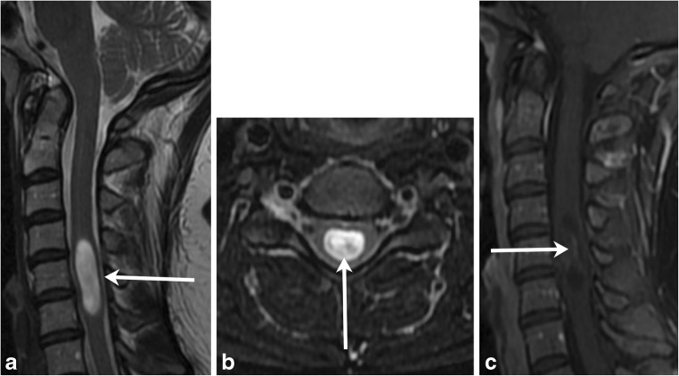 Fig. 13