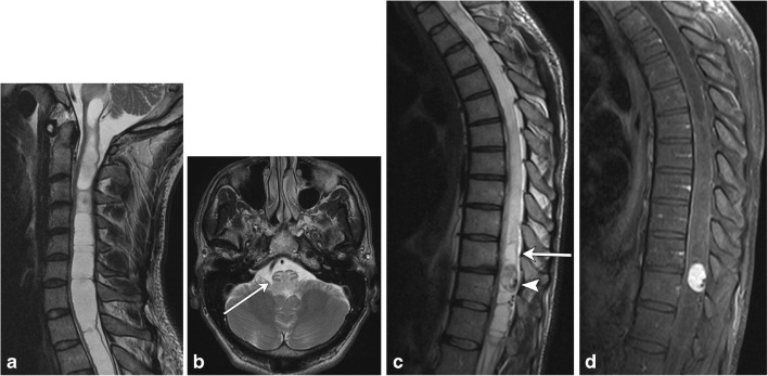 Fig. 14