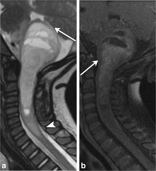 Fig. 15