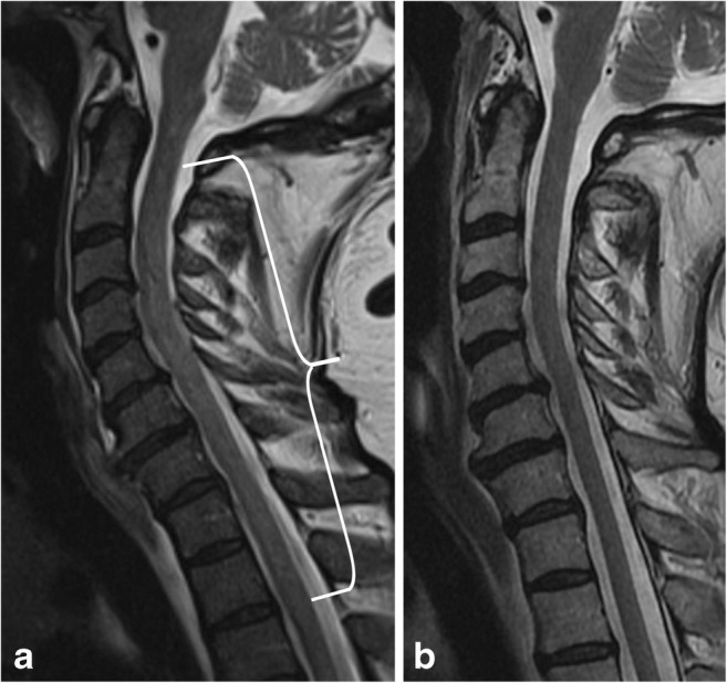 Fig. 12