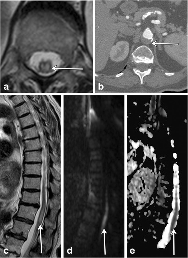 Fig. 22