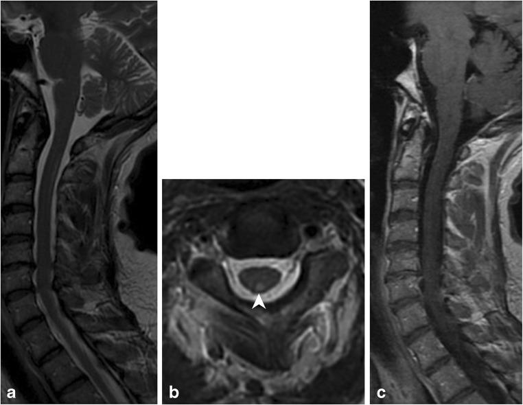 Fig. 10