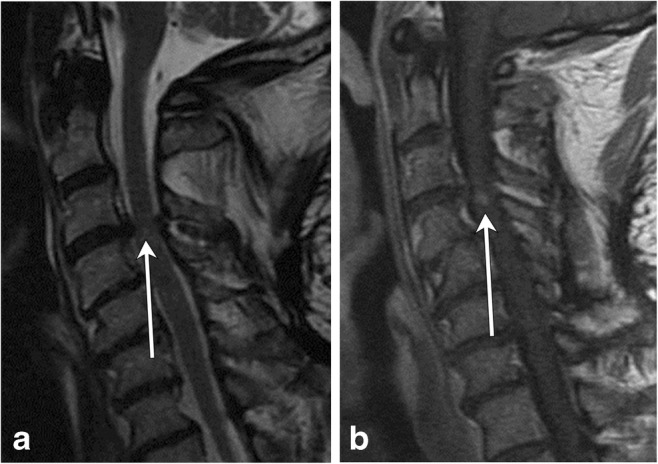 Fig. 23