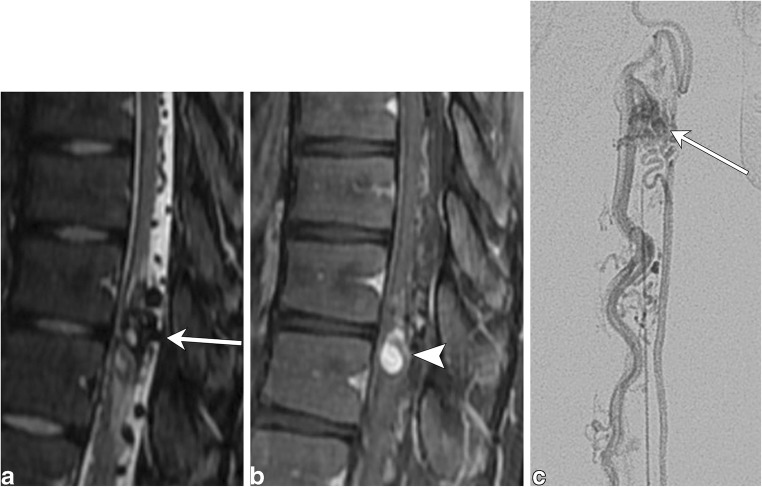 Fig. 20